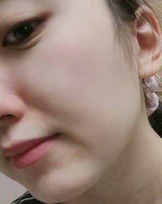올리브영 엘라밴드 하이드로 도트 스팟패치 12mm, 티트리 — 5점을 준 리뷰어가 2022년 10월 올린 사용 사진