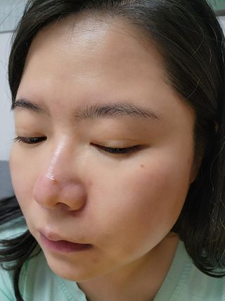 씽크바이오 히알루론 에센스 에어볼 28ea — 4.5점을 준 리뷰어가 2022년 9월 올린 사용 사진