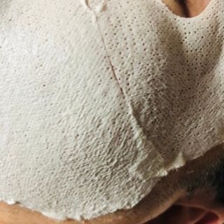 아이디플라코스메틱 페이스핏 플라스터 마스크 _ 리뉴얼 — 5점을 준 리뷰어가 2021년 10월 올린 사용 사진