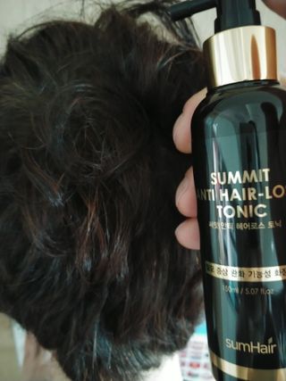 썸헤어 / SUMHAIR 썸헤어 써밋 안티 헤어로스 토닉 — 4.5점을 준 리뷰어가 2021년 5월 올린 사용 사진