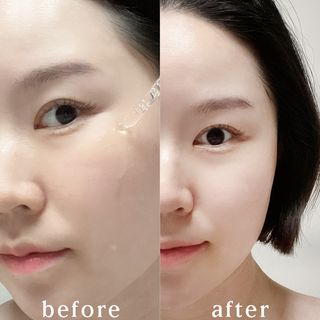 MF[스킨1004] 마다가스카르 센텔라 앰플 100ml — 5점을 준 리뷰어가 2024년 5월 올린 사용 사진