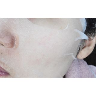 프롬노시베 필앤굿 에센스 마스크 — 3.5점을 준 리뷰어가 2021년 12월 올린 사용 사진