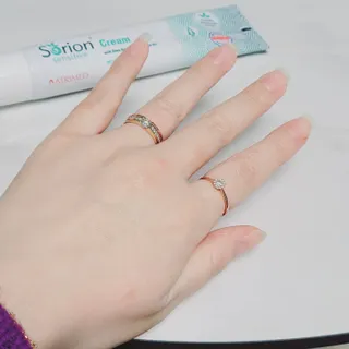 건선/아토/습진/민감성 피부 천연보습진정크림 소리온 크림 & 센시티브 크림 50g — 5점을 준 리뷰어가 2022년 1월 올린 사용 사진