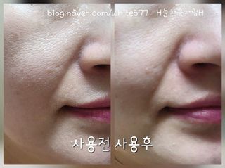 나우 [리브엠] 화해 1등 각질 클렌저! 시카좀 카밍 딥 클렌징 폼 — 5점을 준 리뷰어가 2025년 7월 올린 사용 사진