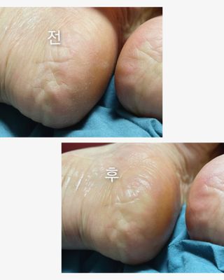 까꿍님이 올린 리뷰 사진 4
