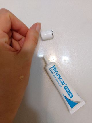 히루스카 포스트아크네 클리어 — 4점을 준 리뷰어가 2021년 2월 올린 사용 사진