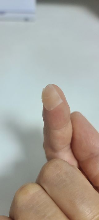 [큐어반H 커팅] 간편하게 떼서 쓰는 자외선차단 습윤밴드 (1팩/30매입) — 5점을 준 리뷰어가 2022년 12월 올린 사용 사진