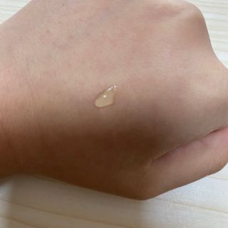 히루스카 포스트아크네 클리어 — 5점을 준 리뷰어가 2021년 1월 올린 사용 사진