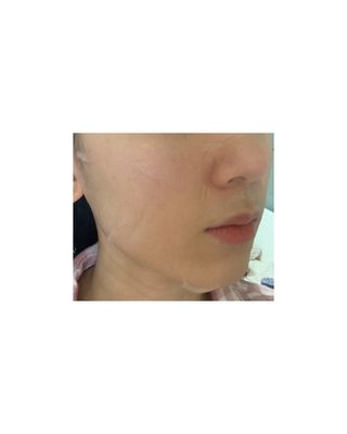 리더스코스메틱 리더스 아임피토 마스크 6종 — 5점을 준 리뷰어가 2021년 12월 올린 사용 사진