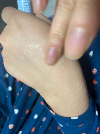 히루스카 포스트아크네 클리어 — 5점을 준 리뷰어가 2021년 1월 올린 사용 사진