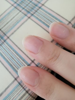 뷰젤 매직케어 네일솔루션 손발톱 보습 영양제 펜슬타입 5ml — 5점을 준 리뷰어가 2022년 4월 올린 사용 사진