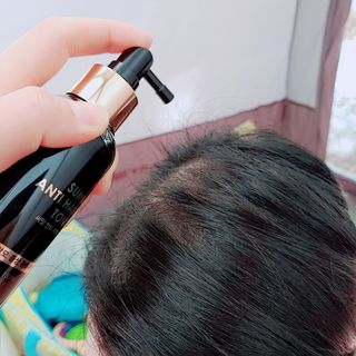 썸헤어 / SUMHAIR 썸헤어 써밋 안티 헤어로스 토닉 — 4.5점을 준 리뷰어가 2021년 6월 올린 사용 사진