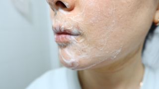 바디셀런스 벤토나이트 데일리 약산성 딥클렌징폼 120ml — 5점을 준 리뷰어가 2021년 12월 올린 사용 사진