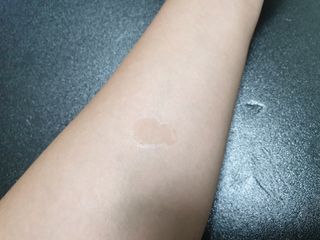 바이오오일 [바이오-오일] 스킨케어 오일 내추럴 60ml — 3.5점을 준 리뷰어가 2021년 11월 올린 사용 사진