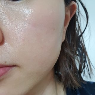 이엔코스 알부틴 알파 화이트닝크림 — 4점을 준 리뷰어가 2021년 2월 올린 사용 사진