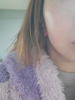 체르엠 스템앤셀 비타민 브라이트닝 에센스 30ml 1개 — 5점을 준 리뷰어가 2022년 2월 올린 사용 사진