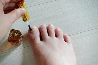 유케어 YOU CARE 문제성 손발톱케어_럭키풋 — 4.5점을 준 리뷰어가 2022년 10월 올린 사용 사진