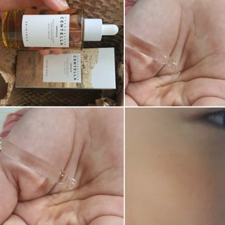 [스킨1004] 마다가스카르 센텔라 앰플 100ml — 4점을 준 리뷰어가 2024년 5월 올린 사용 사진