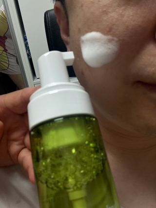 [쿠팡●구매평] 닥터초이스 디판테놀 시카 만능 버블토너 150ml — 5점을 준 리뷰어가 2025년 7월 올린 사용 사진