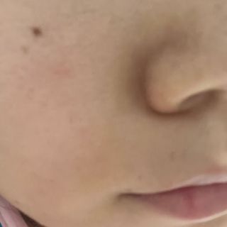 아이앤립 / EYENLIP 아이앤립 연어오일 리바이탈라이징 토너+앰플+크림 3종 세트 — 5점을 준 리뷰어가 2021년 8월 올린 사용 사진