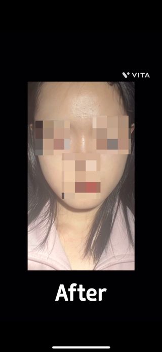 틱톡 캠페인 ★ ｜ Tiktok x 0.8L 에스트라리제덤 (최종_방문형) — 5점을 준 리뷰어가 2024년 10월 올린 사용 사진