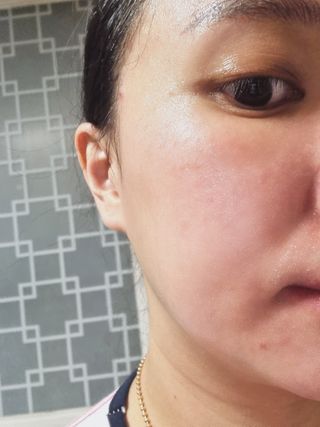 바이오오일 [바이오-오일] 스킨케어 오일 내추럴 60ml — 5점을 준 리뷰어가 2021년 12월 올린 사용 사진