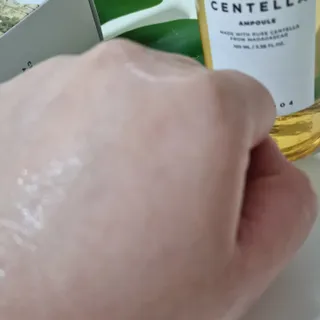 [스킨1004] 마다가스카르 센텔라 앰플 100ml — 5점을 준 리뷰어가 2024년 5월 올린 사용 사진