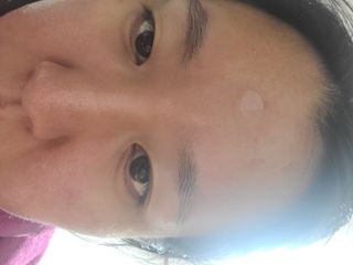 마이디플러스 트리플부스팅, 트러블 릴리프 케어 마이크로 패치 2종 중 택1 — 5점을 준 리뷰어가 2021년 11월 올린 사용 사진
