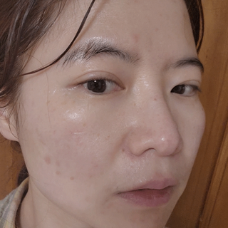 세뚜아(Cettua) 나우[세뚜아] 포레스트 수딩 마스크 Cettual Forest  Soothing Mask 4매 — 5점을 준 리뷰어가 2024년 3월 올린 사용 사진