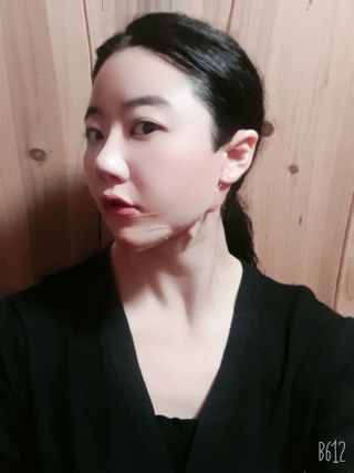 아이디플라코스메틱 아이디 페이스핏 마이너스 밴드 v2 — 5점을 준 리뷰어가 2020년 12월 올린 사용 사진