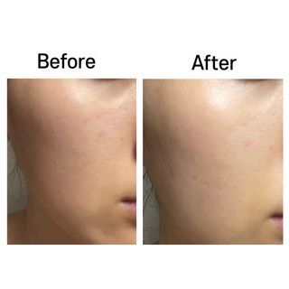 프리[더메디코템] 일루미네이팅 화이트 셀 앰플 — 5점을 준 리뷰어가 2024년 7월 올린 사용 사진