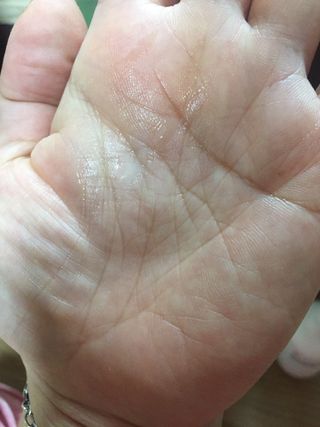 리더스코스메틱 리더스 카밍 바이오틱스 에센스 워터 — 5점을 준 리뷰어가 2022년 2월 올린 사용 사진