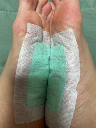 [레제르] 아로마 수액패치 발패치 30매입 -라벤더향/유칼립투스향/대나무향 — 5점을 준 리뷰어가 2022년 5월 올린 사용 사진