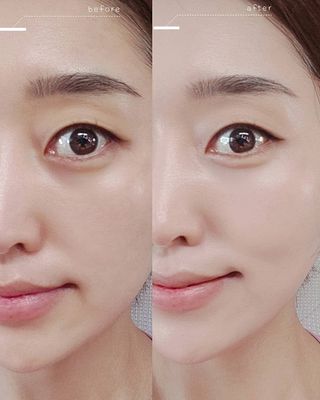 부산언니님이 올린 리뷰 사진 4