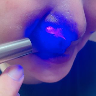 메데스 비츠케어 모공케어 피부관리키트 — 4점을 준 리뷰어가 2021년 7월 올린 사용 사진