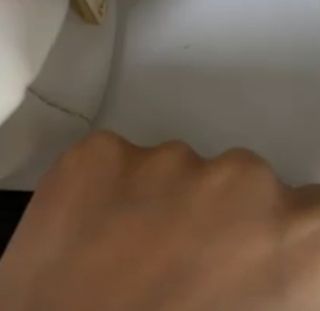파시랩 레티닐 링클 트리트먼트 — 5점을 준 리뷰어가 2021년 9월 올린 사용 사진