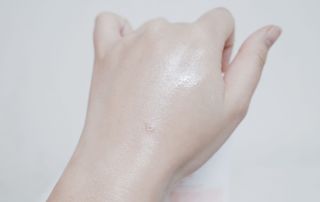 바이오오일 [바이오-오일] 바디 로션 175ml — 5점을 준 리뷰어가 2021년 11월 올린 사용 사진