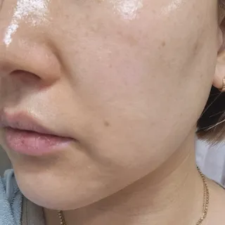 렉스리 닥터 올인원 세럼 Rexri Dr.All-in-one Serum — 5점을 준 리뷰어가 2022년 11월 올린 사용 사진
