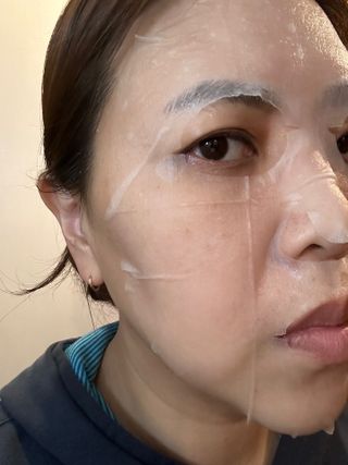세뚜아(Cettua) 세뚜아 스팟 클리어 듀얼 패치 Cettua Spot Clear Dual Patch — 5점을 준 리뷰어가 2023년 11월 올린 사용 사진