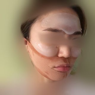아이디플라코스메틱 아이디 페이스핏 플러스 패치 v2 — 1점을 준 리뷰어가 2021년 4월 올린 사용 사진