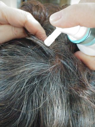 모두발라 탈모집중케어 헤어토닉 — 5점을 준 리뷰어가 2022년 1월 올린 사용 사진