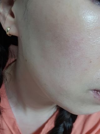 [후르디아] 골라쓰는 비건마스크팩 2종 -백년초 / 망고 — 5점을 준 리뷰어가 2021년 9월 올린 사용 사진