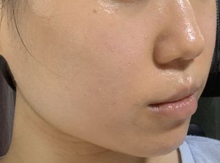 뷰티메드 OFL 리밸런싱 케어 크림 50ml — 5점을 준 리뷰어가 2022년 7월 올린 사용 사진