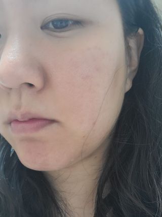 셀바이져 지우개 미스트 피부 보호 입주변 트러블 진정 케어 아기 안개분사 미스트 — 5점을 준 리뷰어가 2021년 3월 올린 사용 사진