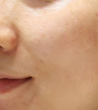 레드투래드 센서티브 슈퍼 크림 50ml — 5점을 준 리뷰어가 2021년 9월 올린 사용 사진