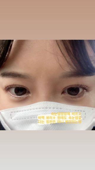 피부미 골드베릴 아이래쉬 앰플 10ml — 4.5점을 준 리뷰어가 2021년 9월 올린 사용 사진