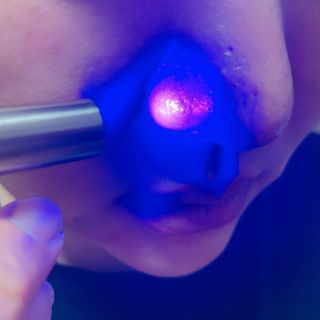 메데스 비츠케어 모공케어 피부관리키트 — 4점을 준 리뷰어가 2021년 7월 올린 사용 사진