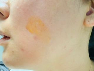 유니베르소 로즈힙 오일 15ml — 5점을 준 리뷰어가 2021년 7월 올린 사용 사진