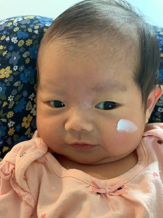 젠바이오 코스메틱스 젠바이오수딩크림]   가려운 피부 & 아토피 원픽 크림 — 4.5점을 준 리뷰어가 2022년 8월 올린 사용 사진