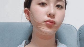 아이디플라코스메틱 아이디 페이스핏 마이너스 밴드 v2 — 5점을 준 리뷰어가 2022년 5월 올린 사용 사진